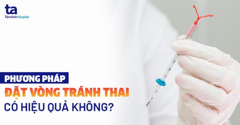 Hình ảnh minh họa một chiếc vòng tránh thai bằng đồng (Copper IUD) được đặt trong tử cung, thể hiện cơ chế ngăn ngừa thai